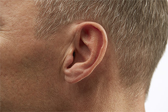 Invisible-in-the-Canal (IIC) Hearing aid style